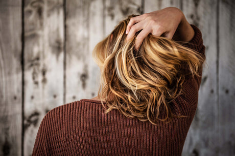 Hair loss and hormones